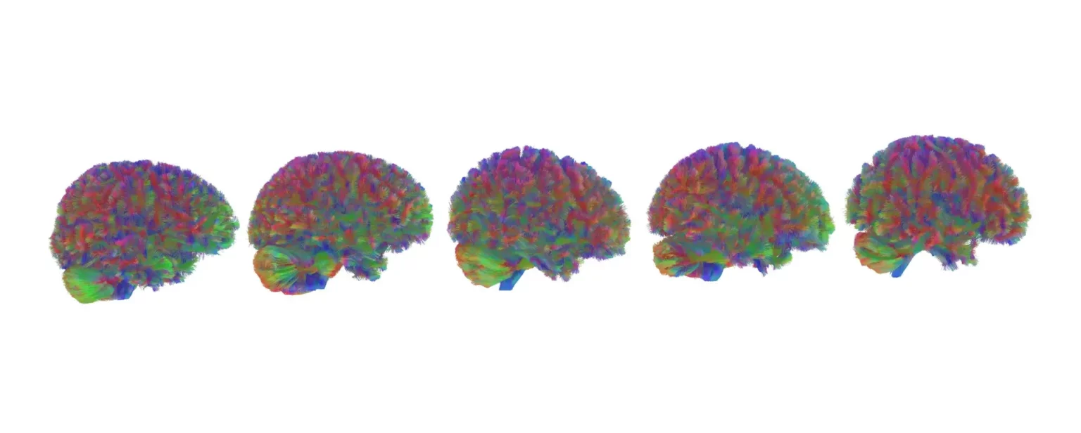 Le cinque ere del cervello umano: scopri quando finisce l’adolescenza cerebrale Le età del cervello (Immagine CC studio università di Cambridge)