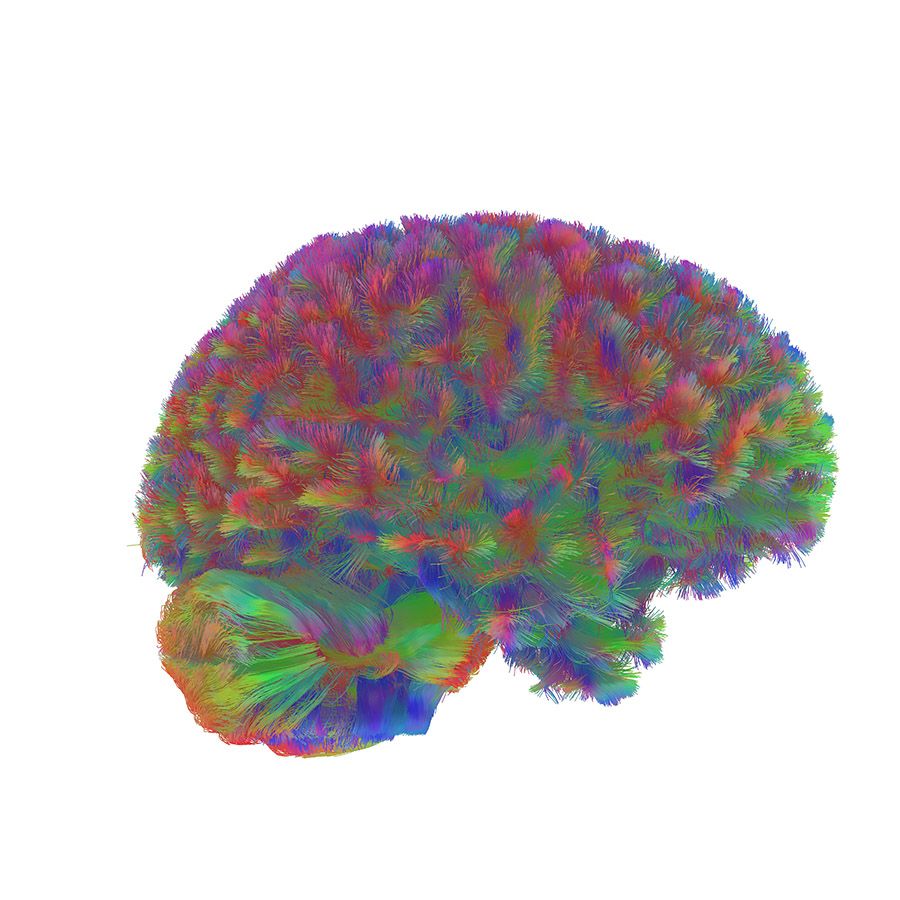 Un cervello adolescente bello grosso (Immagine CC studio università di Cambridge)